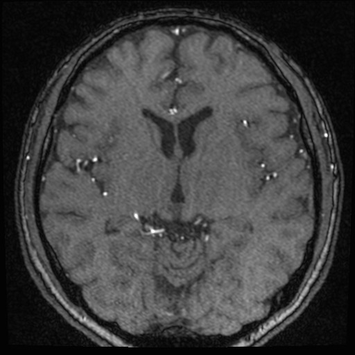 Click on the Serie image to view the images of VILLANUEVA, WILLIAM A.